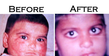 Before-After Images